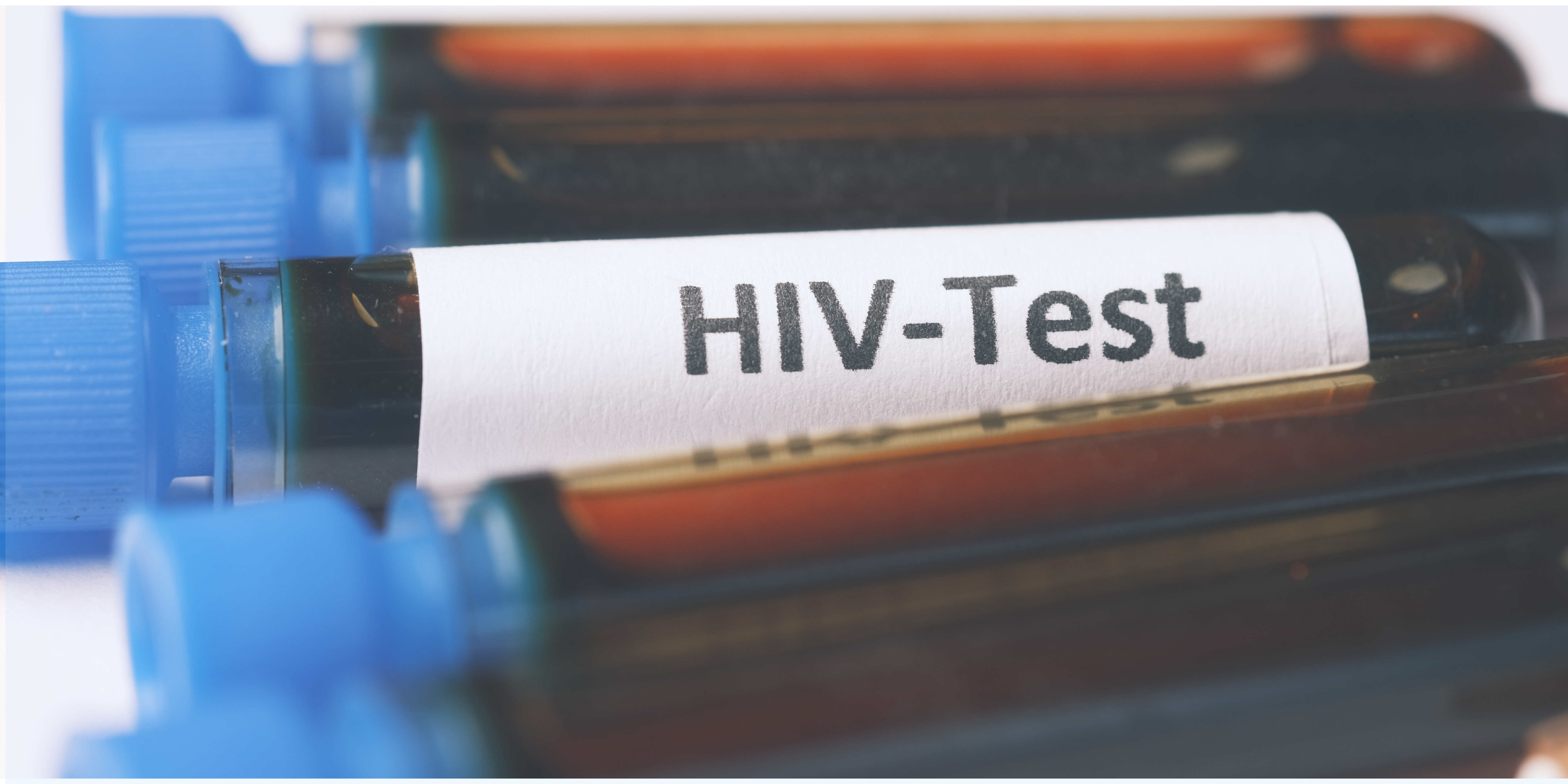HIV test
